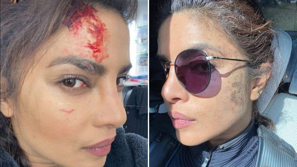 Priyanka Chopra gets wounded while shooting for Citadel - See pic