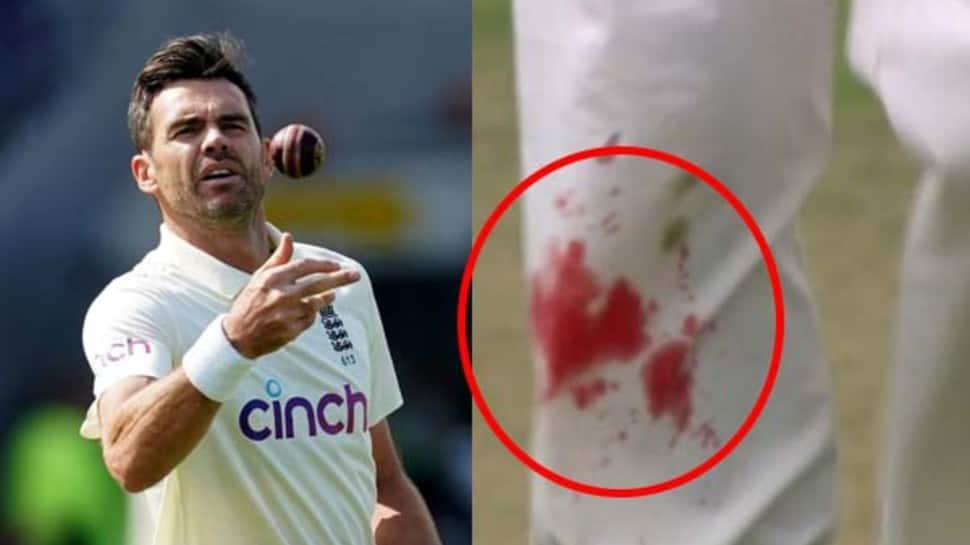 India vs England 4th Test: James Anderson bowls with bleeding knee, video goes viral - WATCH