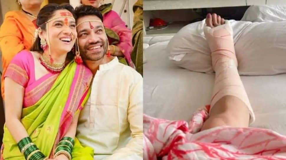 Ankita Lokhande suffers leg injury ahead of her wedding with beau Vicky Jain! 