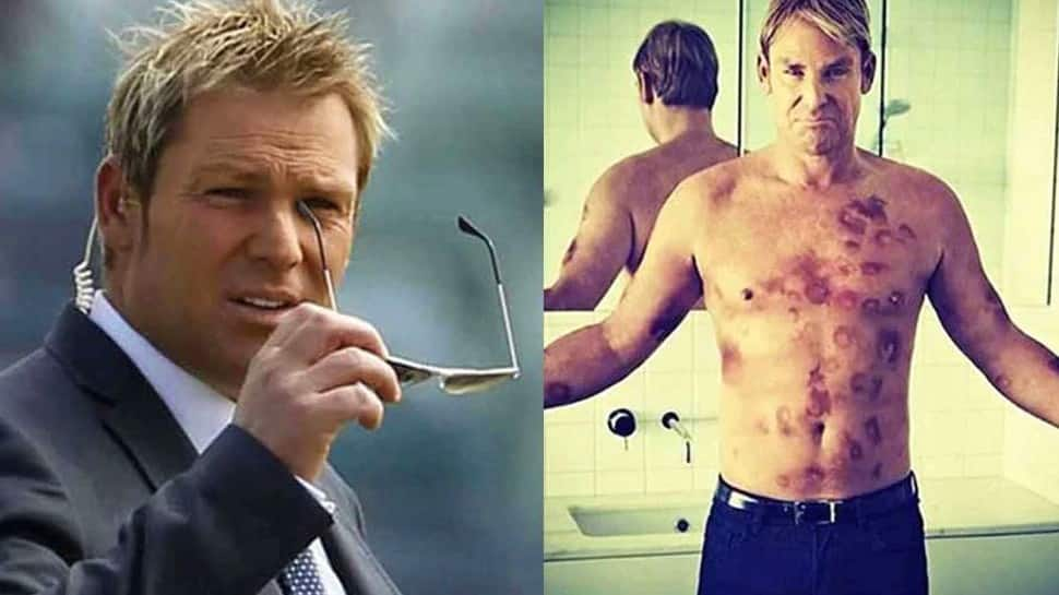 Shane Warne was involved in a sex scandal in 2006 with two models during a county game in England. Speaking about the incident, Coralie Eichholz said, “Shane blew our minds. He was so fit. I’d give him top marks for more than satisfying us.” (Source: Twitter)