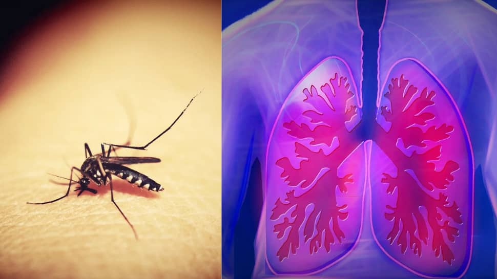 Anti-malaria drugs effective in fighting pulmonary disease: Study