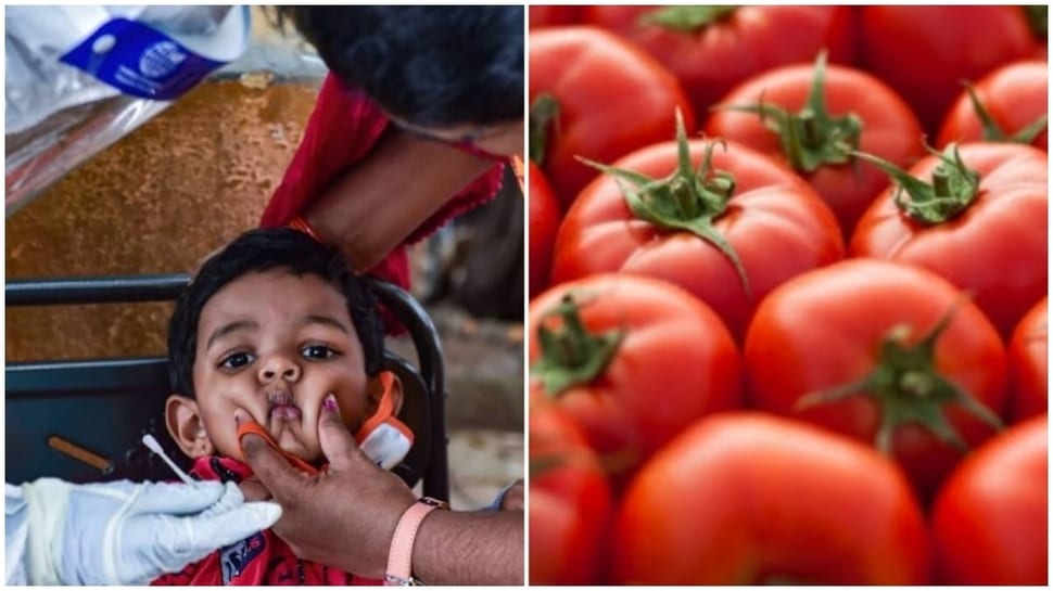Tomato Fever: Feed a lot of water to infected children, take a bath by mixing... Tomato Fever: Feed a lot of water to infected children, take a bath by mixing...