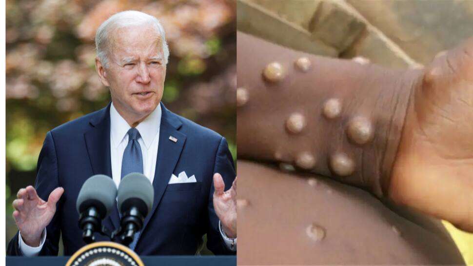 Monkeypox is a matter of concern: US President Joe Biden