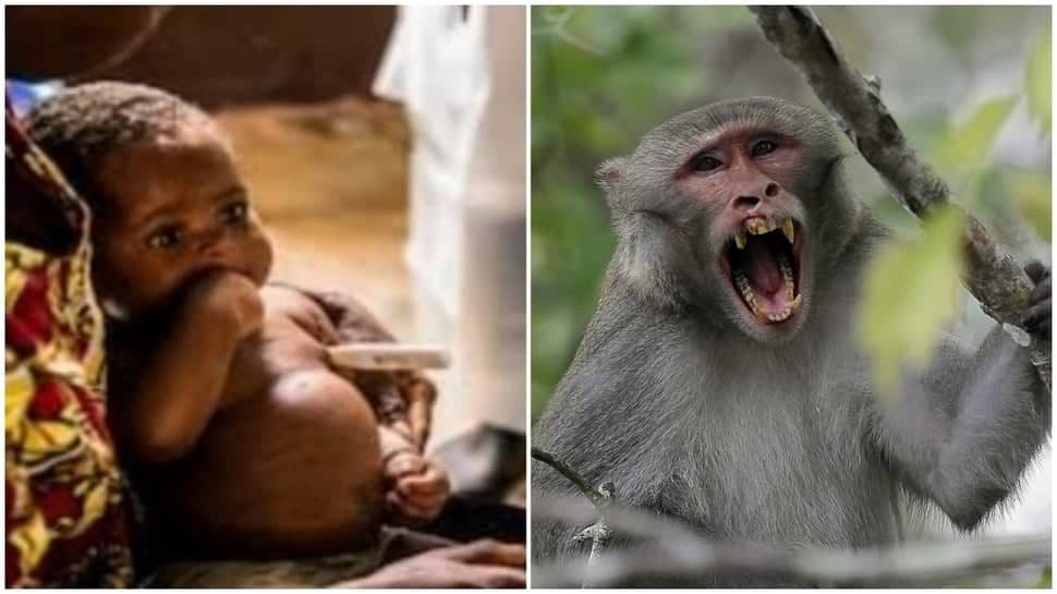 Monkeypox outbreak started in India? Doctors advises to follow THIS path, not to...