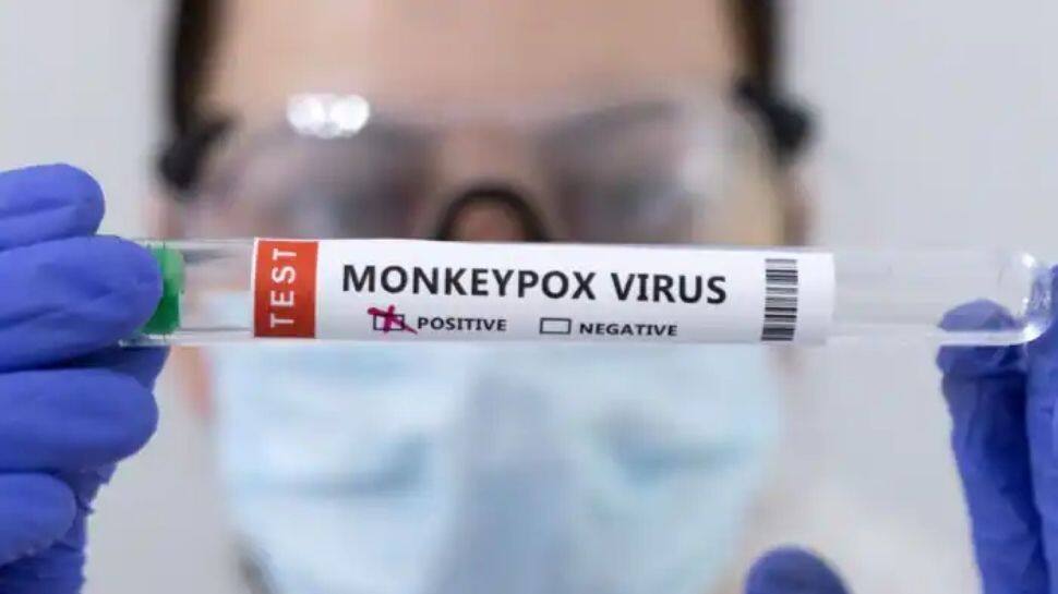 Monkeypox virus detected in Argentina; two confirmed cases