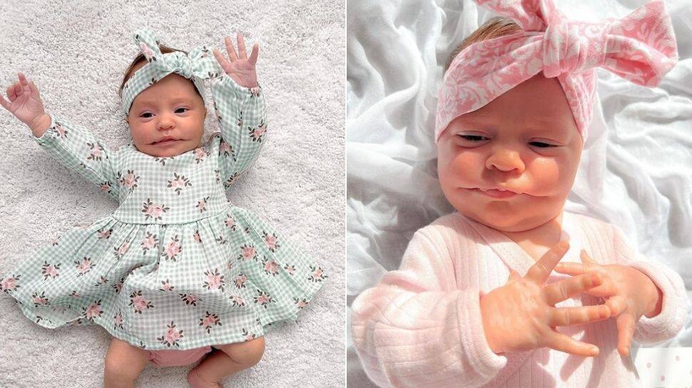 Baby born with 'permanent smile', parents open TikTok account to spread awareness on rare condition | World News - Vimarsana News