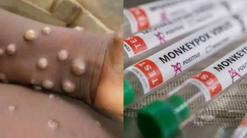 Monkeypox will never be eliminated but...&#039;: Report on rare virus reveals THIS