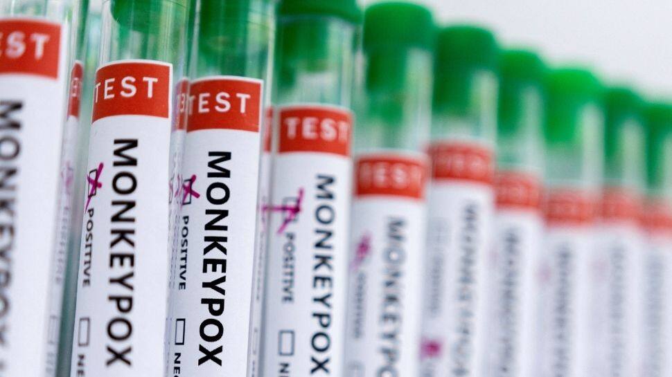 Monkeypox virus outbreak: Ireland, Argentina latest countries to report cases; global tally crosses 200