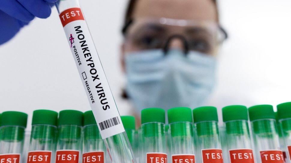 L’inquiétude liée à la variole du singe augmente !  Une agence de santé en Angleterre dit qu’il y a une propagation communautaire |  Nouvelles du monde