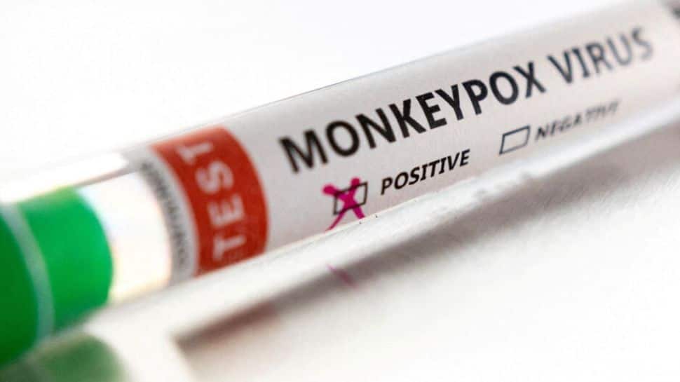 Two monkeypox strains in US suggest possible undetected spread