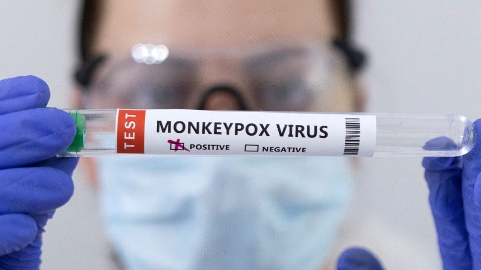 What to do if you contract monkeypox virus?