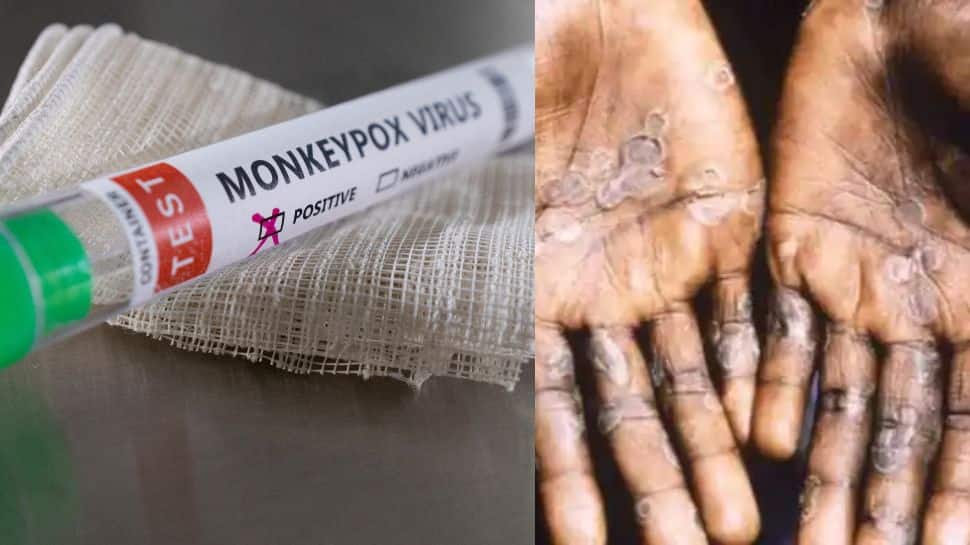 Monkeypox virus outbreak: German panel recommends vaccines as cases cross over 1000 globally