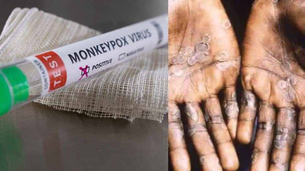 Épidémie de virus Monkeypox: un panel allemand recommande des vaccins alors que les cas traversent plus de 1000 dans le monde |  Nouvelles du monde