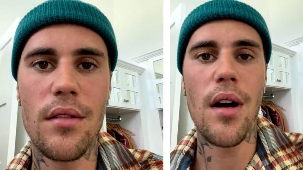 Justin Bieber&#039;s facial paralysis due to rare disorder Ramsay Hunt syndrome: VIDEO