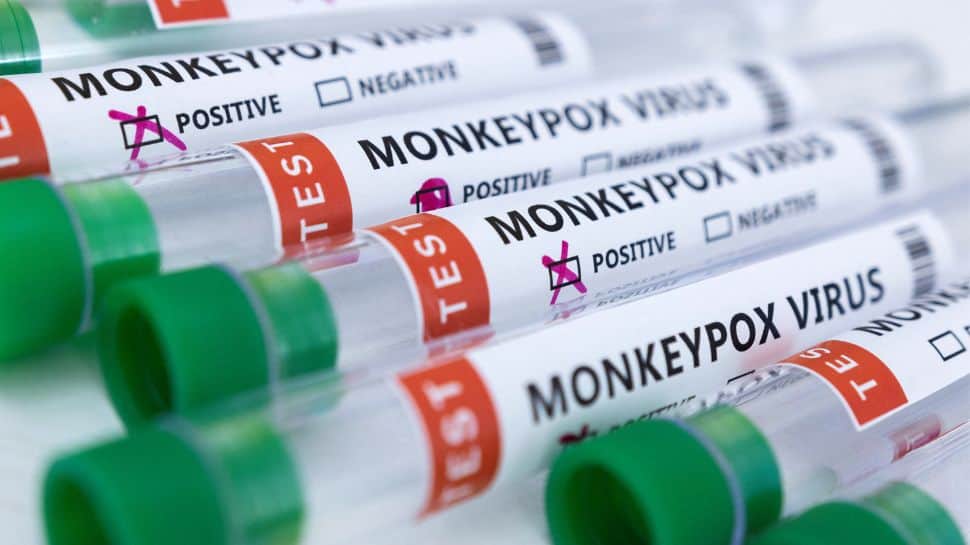 Épidémie de virus Monkeypox: les États-Unis en alerte, intensifient les tests parmi 142 cas confirmés |  Nouvelles du monde
