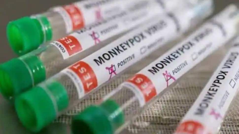 Is Monkeypox virus mutating more rapidly than expected? Here&#039;s what researchers say