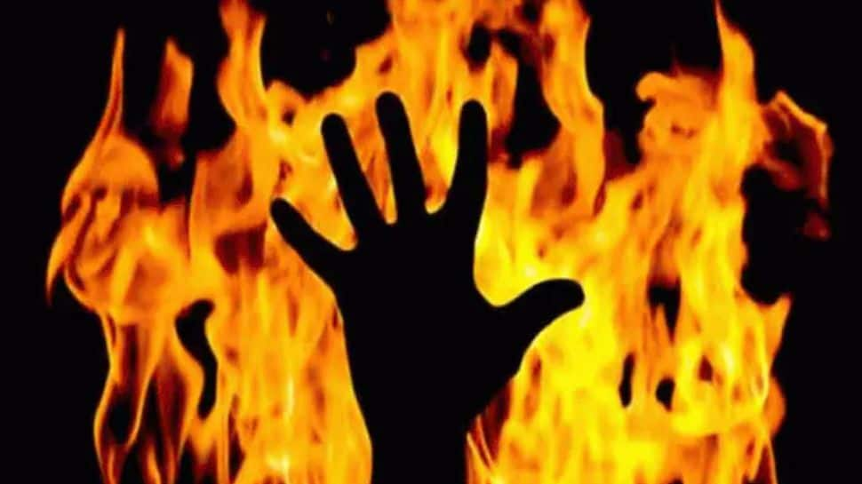 Madhya Pradesh: Tribal woman battles for life after being set ablaze in Guna, 2 arrested