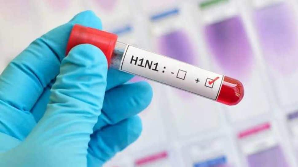 Is Swine Flu season beginning? Who is at risk for infection? All you need to know