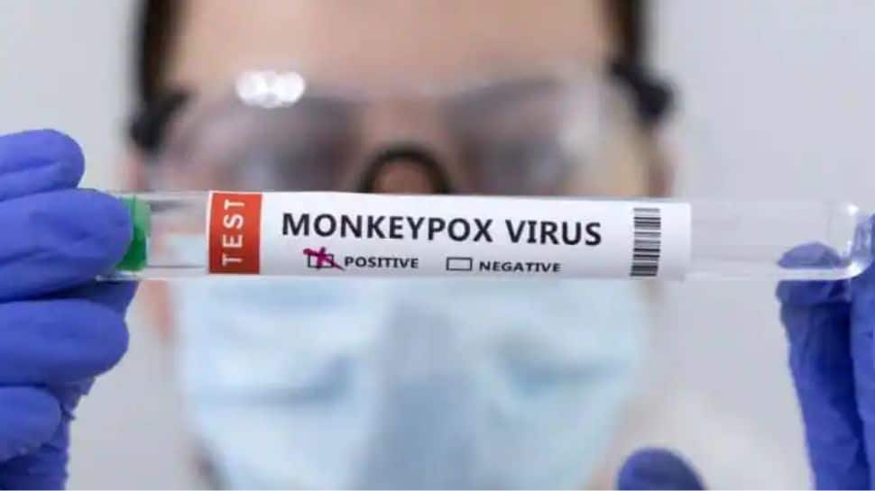 Monkeypox alert! Now, suspected case found in UP’s Noida, details here