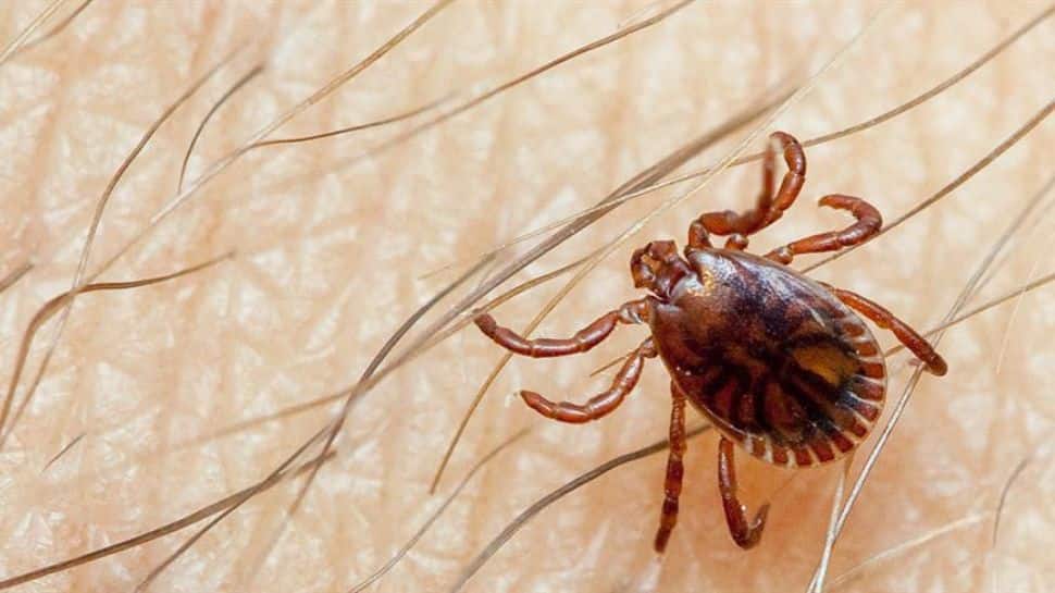Crimean-Congo Haemorrhagic Fever case reported in Spain - Know all about tick-borne viral disease here