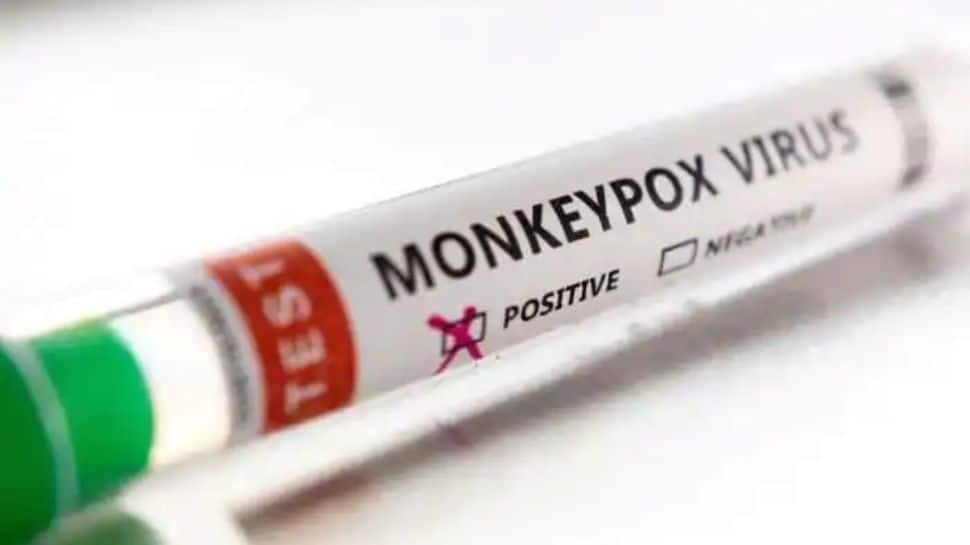 Monkeypox BIG UPDATE: Kerala reports 5th case, patient had traveled to UAE - Vimarsana News
