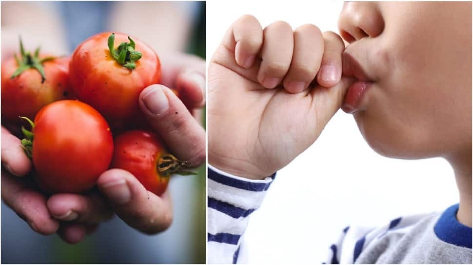 Tomato fever SPREADS in India: STOP your children from sucking their fingers, OTHERWISE...