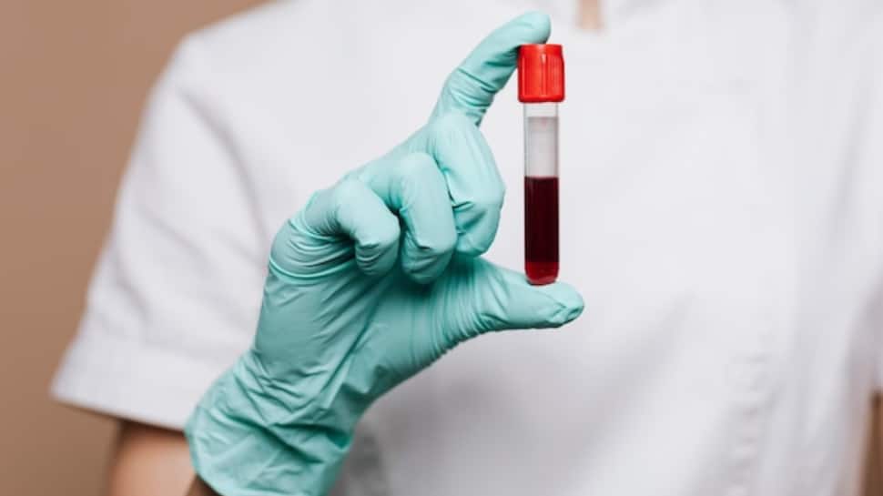 Blood tests might help to detect long covid in patients, suggests research