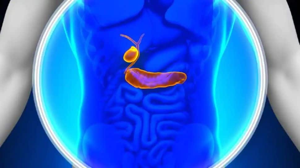 Scans fail to detect cancer cells in the pancreas: Research
