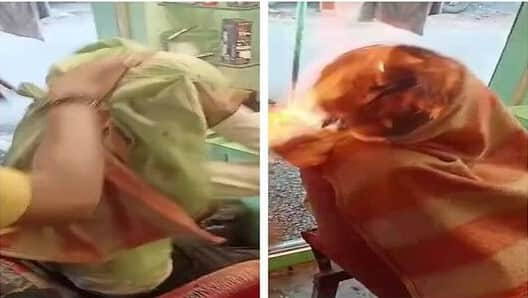 SHOCKING! Gujarat man suffers severe burns after &#039;FIRE HAIRCUT&#039; goes extremely wrong