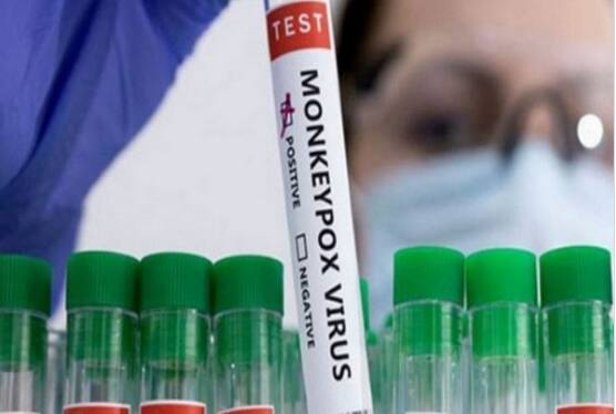 Monkeypox devrait continuer à être classé comme urgence sanitaire mondiale: OMS |  Nouvelles du monde