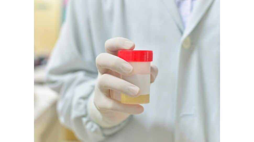 Fake Pee For Drug Test: Review Of The Best Synthetic Urine Kits On The Market