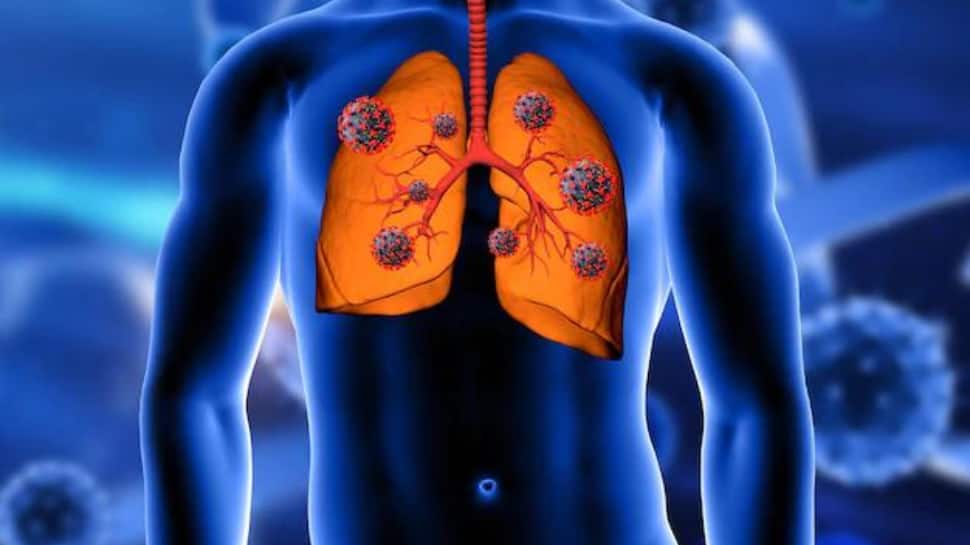 World Pneumonia Day: Maintain your respiratory health this winter with these tips