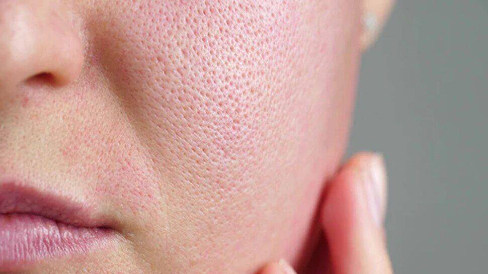 Face Exercise For Open Pores At Dylan Belstead Blog