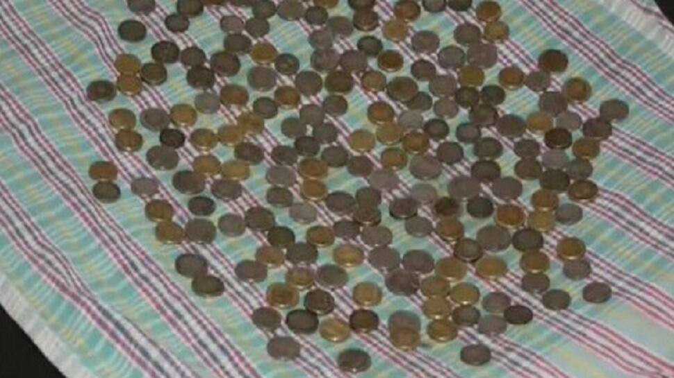 SHOCKING! 187 coins found in man’s stomach in Karnataka, removed after endoscopy