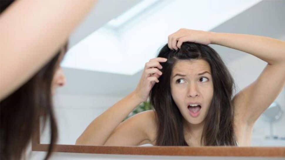 Get rid of dandruff with these 5 DIY home remedies for some haircare in  winter | Beauty/Fashion News | Zee News