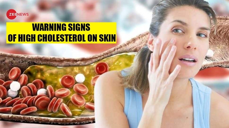 併存疾患とは何ですか?