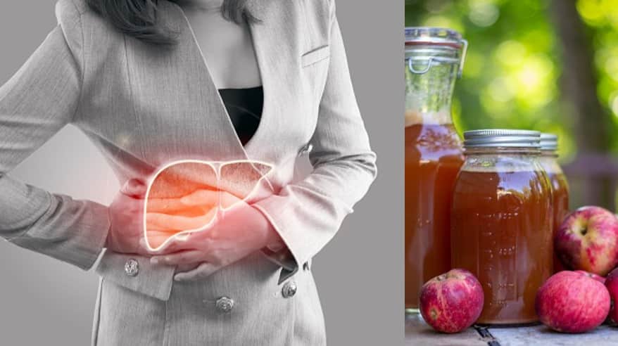 Apple Cider Vinegar for Fatty Liver: 3 Efficient Dwelling Cures For a Protected Detox