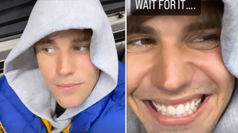 Justin Bieber Updates Fans About His Partial Facial Paralysis Condition Shares Video People