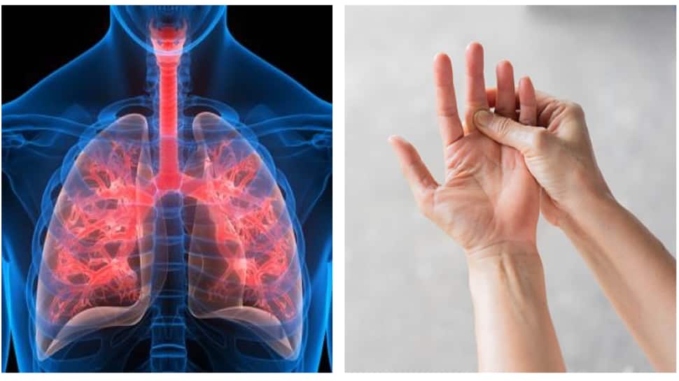 Can Rheumatoid Arthritis Cause Lung Disease? Check How The Two Conditions Are Linked