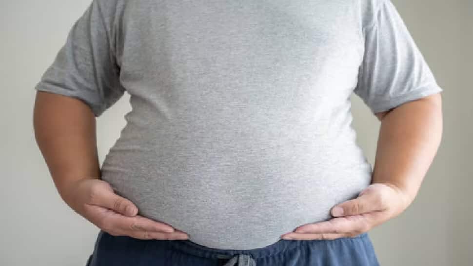 People With Gene-Linked Obesity Have A Lower Risk Of Developing Heart Diseases: Study