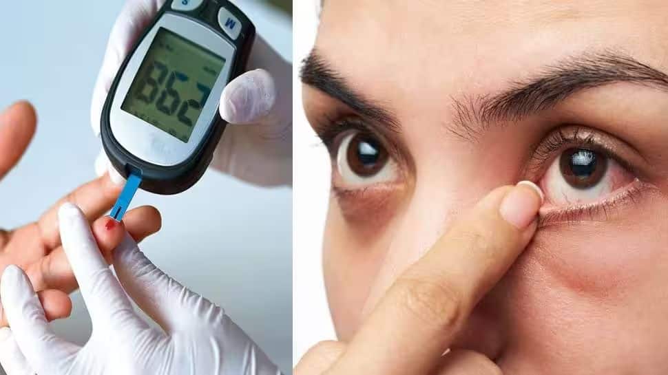 High Blood Sugar: How Diabetes Can Affect Eyes, Expert Explains