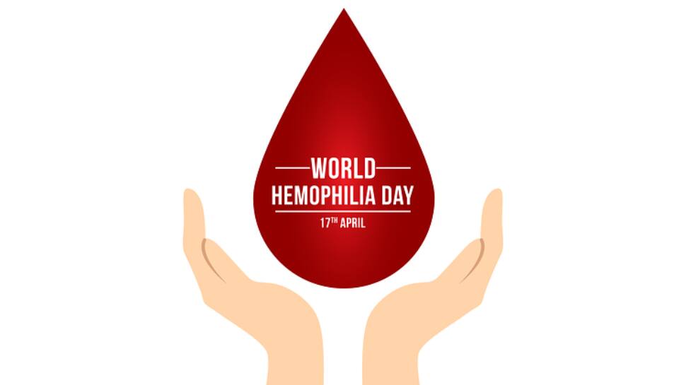 World Hemophilia Day 2023: Symptoms, Causes, Diagnosis And Treatment Of This Rare Blood Disorder