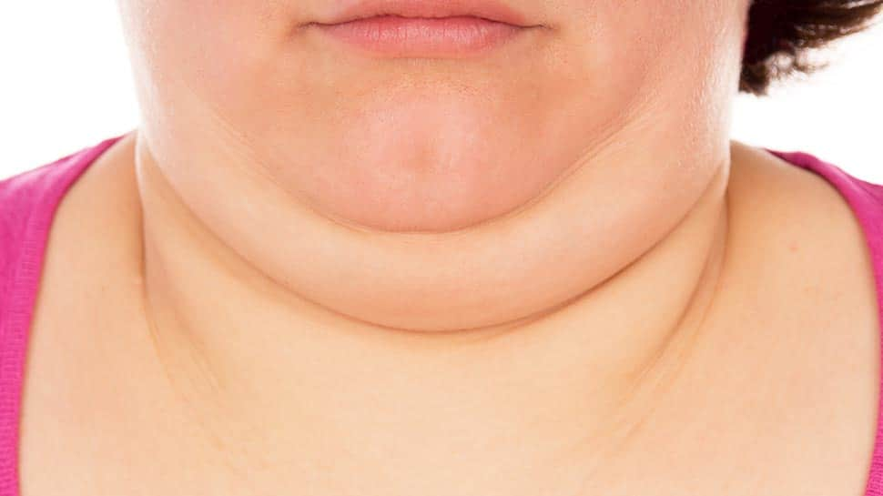 Want To Get Rid Of That Stubborn Double Chin? Try These Facial Yoga Exercises