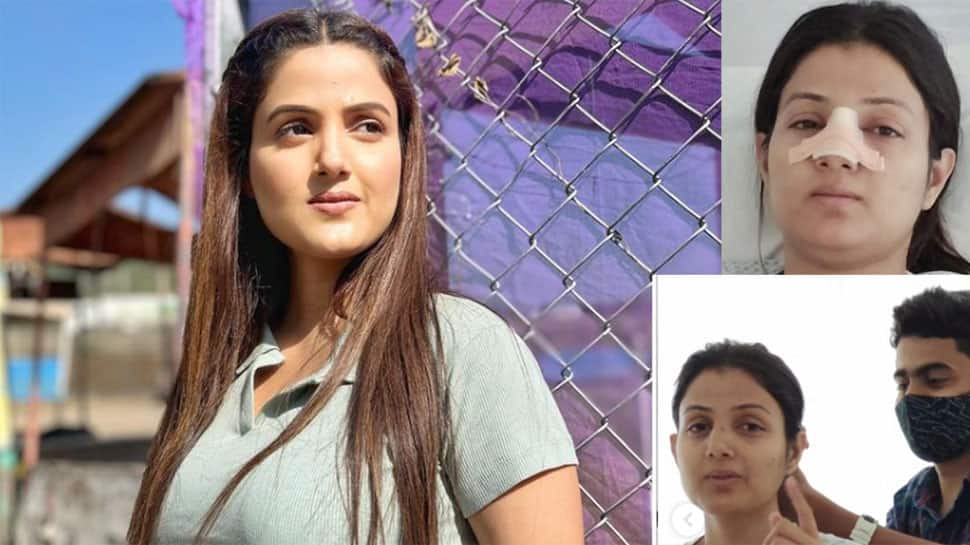 Actor Sumati Singh Undergose Nose Surgery After Injuring Her Face In Horrific Accident - See Pics