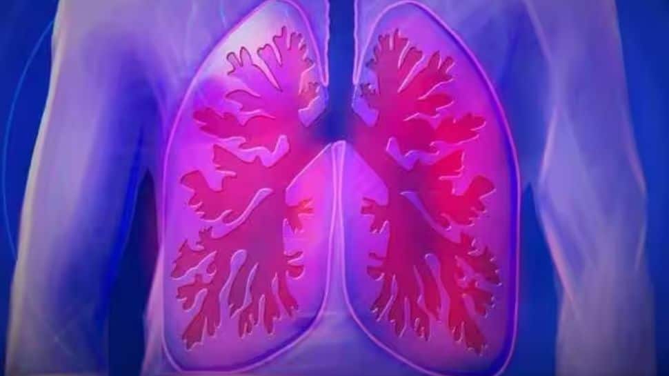 Omega-3 Fatty Acids May Help In Boosting Lung Health: Study