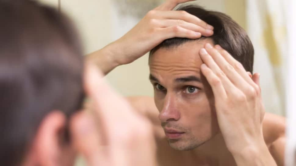 EXCLUSIVE: Common Doubts And Misconceptions About Hair Transplants, Expert Spells Out