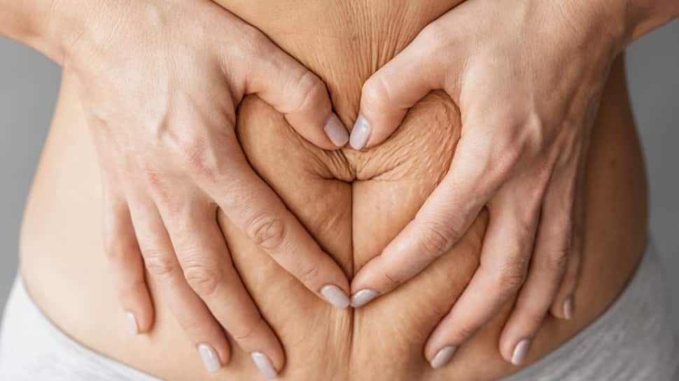 11 Essential Concepts To Get Perfect Abdomen With Tummy Tuck Surgery In  India