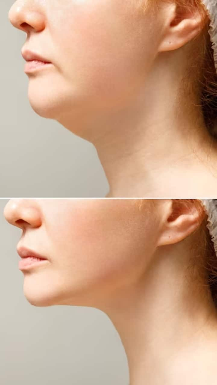 Exercises to get rid of face and neck fat hot sale