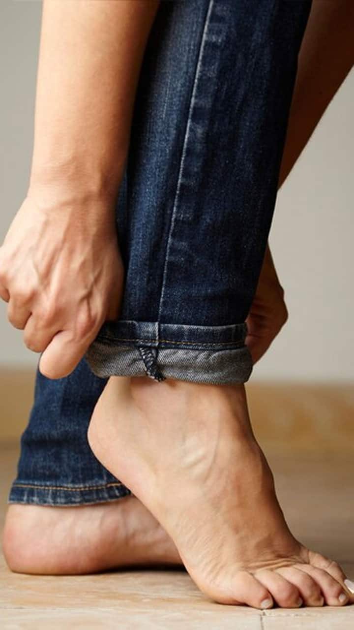10 Simple Remedies for cracked heel