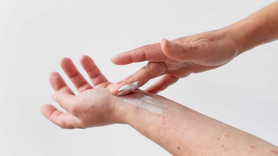 Frequently Using Antifungal Skin Medicines? Study Explains Why You Must Be Careful 